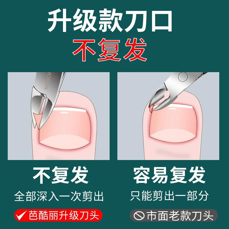 Yanjia Gully incrustamiento de uñas inclinadas cortador de uñas pie cortar tijeras de recorte de una sola herramienta pinza de boca de águila image 3