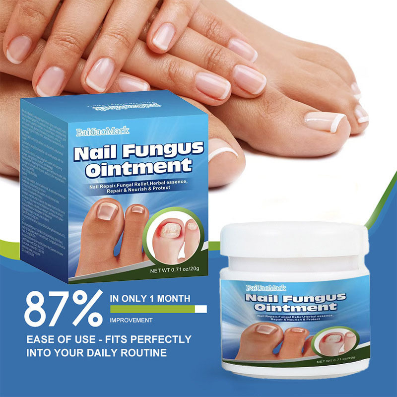 Jiaogoukang Antibacterial Cream Amazon Aliexpress Cross-Border Nail Fungus Care Cream Brightening and Softening Nail Removal and Repair Cream Jiaogoukang Antibacterial Cream Amazon Aliexpress Cross-Border Nail Fungus Care Cream Brightening and Softening Nail Removal and Repair Cream