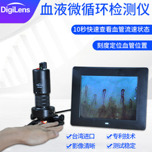 台湾进口虔茂DMX980-1血液微循环检测仪甲壁末梢血管查看高清显示