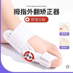 足の指の矯正器の親指の外反は大きい足の骨の突出の神器を是正します。
