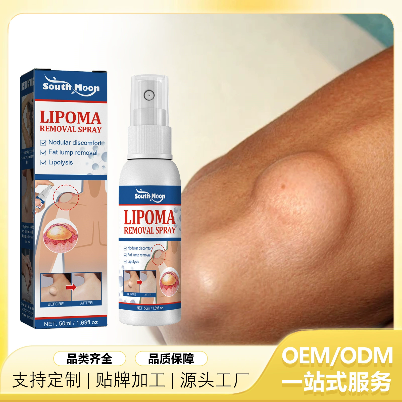 Брызги заботы тела узла жировых отложений задней части ног ремонта сброса брызг узла Южной Луны жирные