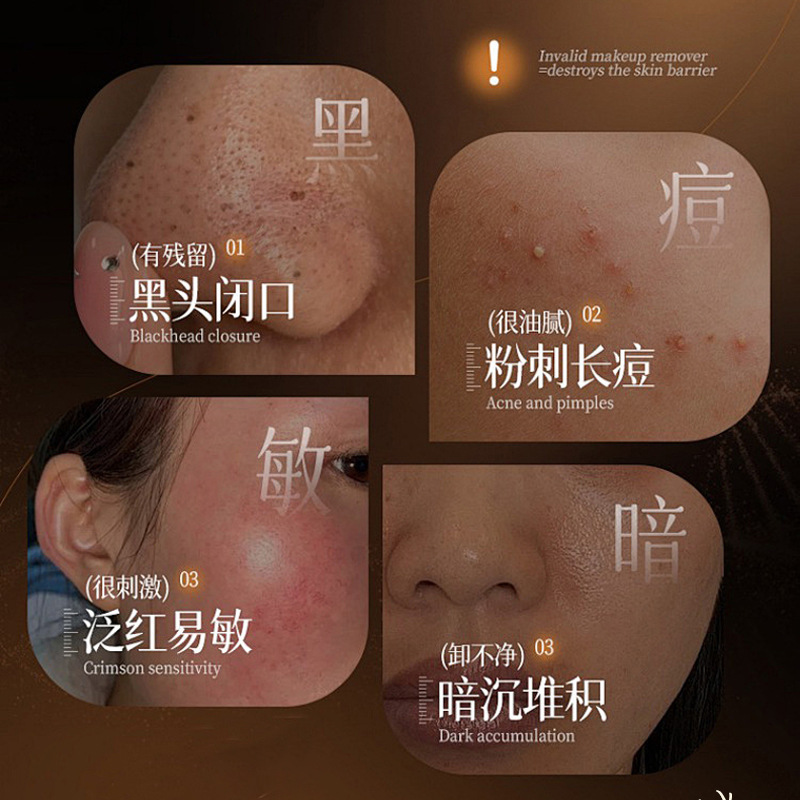 素秀臣氏肌底净透焕肤调理水层孔菌维生素原B5保湿水透亮厂家代发|undefined