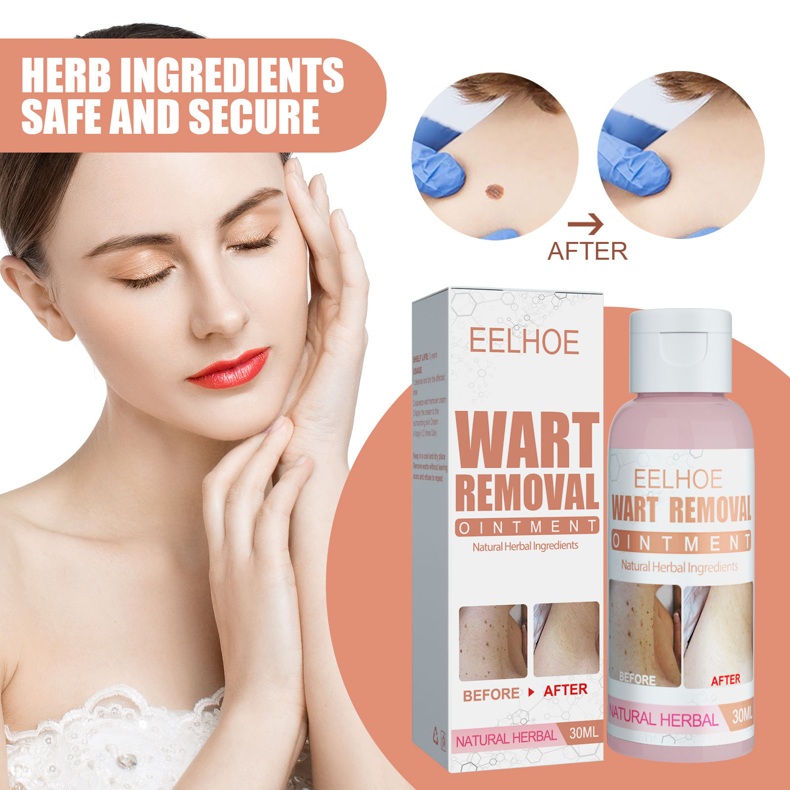 EELHOE for skin repair, body care, hands, feet, face, and underarm wart cream_voghion.com
