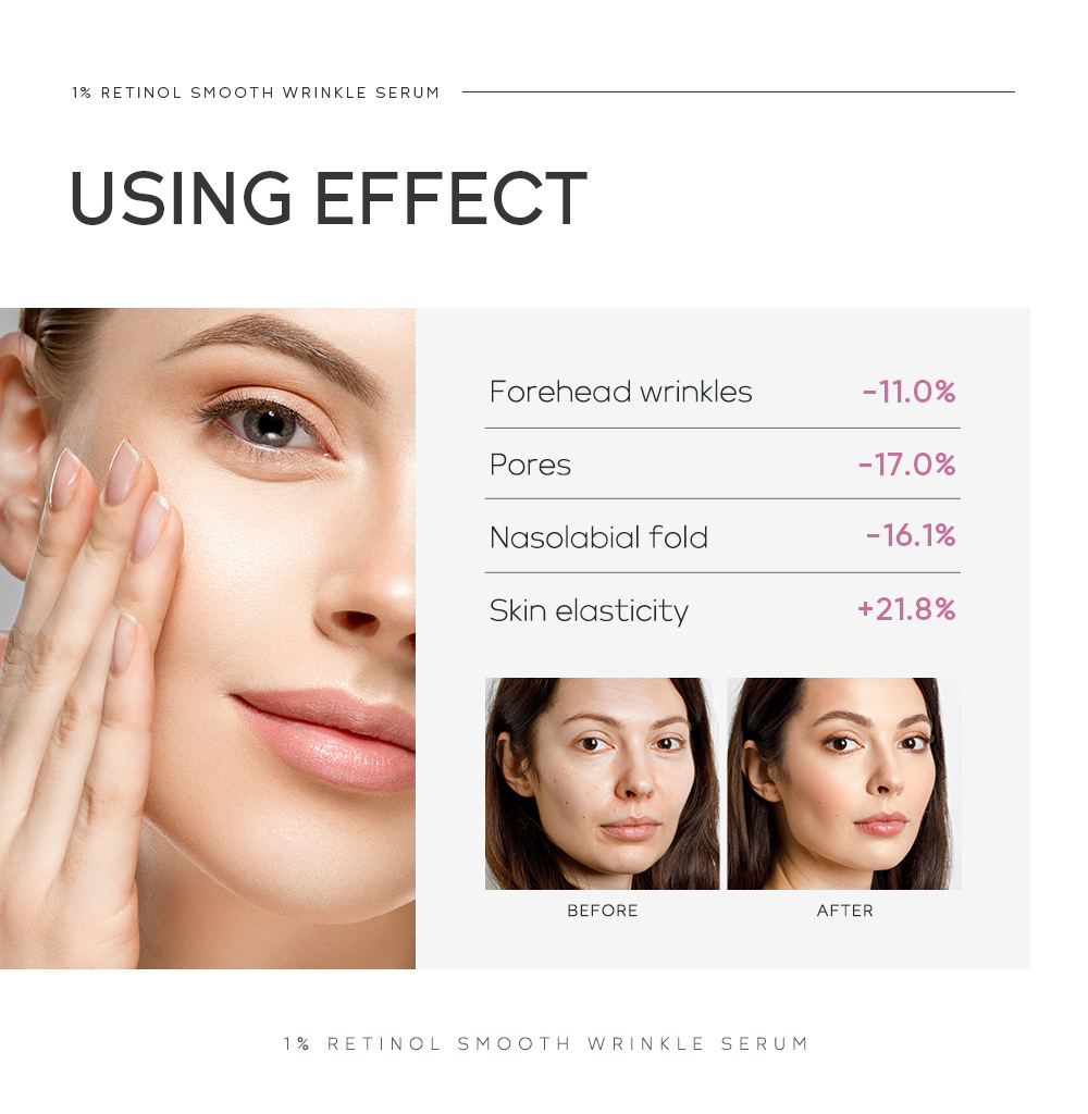 Quiyum 1% Retinol Revitalizing Essence 17ml Hydrates, moisturizes and brightening skin tone. Cross-border manufacturer's wholesale in stock undefined