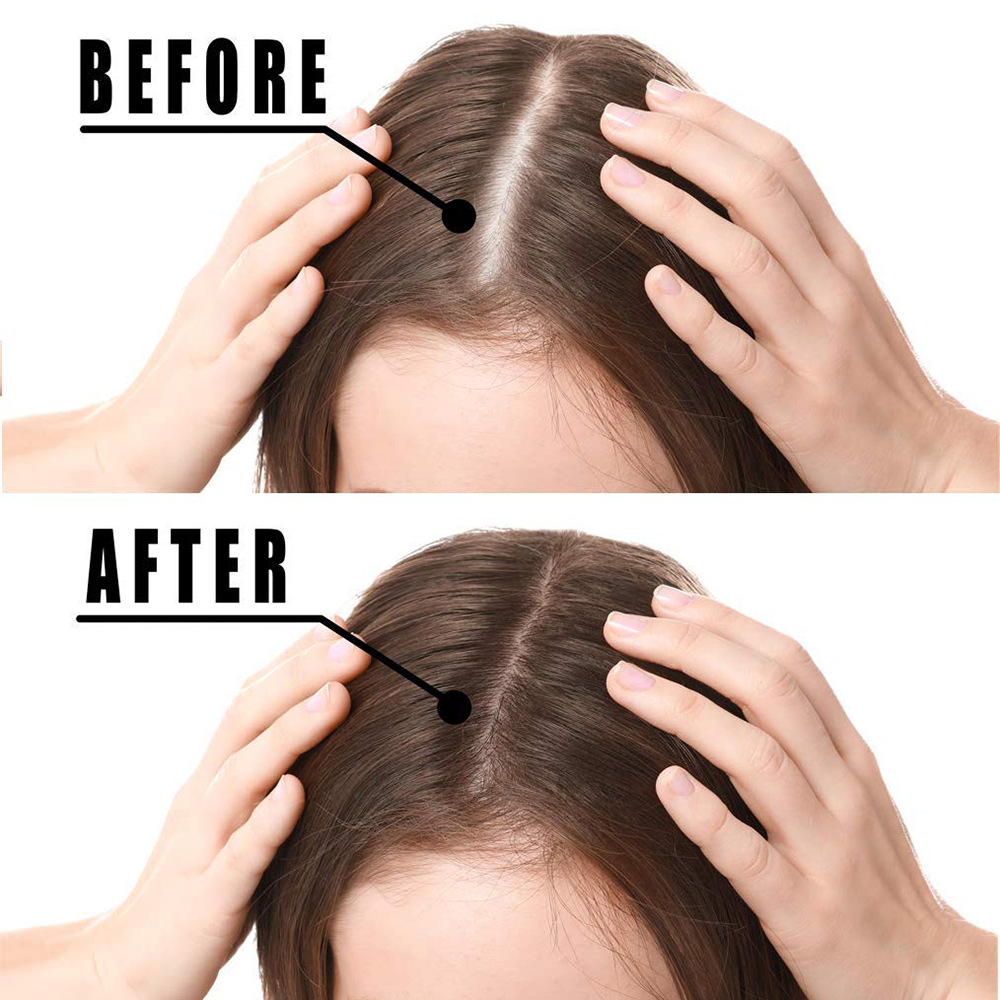 TONISABERY Olio di zenzero 30 ml Essenza per la cura della pelle liscia e forte e resistente delle doppie punte_voghion.com