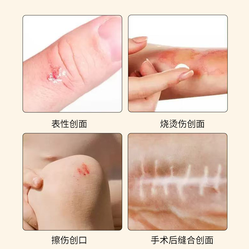 医療用再構築コラーゲンゲルドレッシング術後修復火傷火傷治癒修復ゲルOEMカスタマイズ|undefined