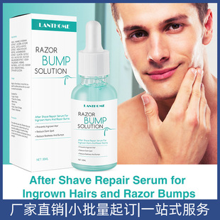 Cross-Border Hair Growth Prevention Essence Prevent Growth in Hair Hair Growth Prevention Essence