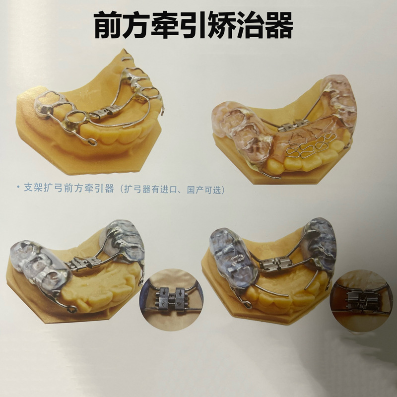 儿童功能性矫治器模型环绕保持器哈雷氏保持器上颌平面导板牙模型
