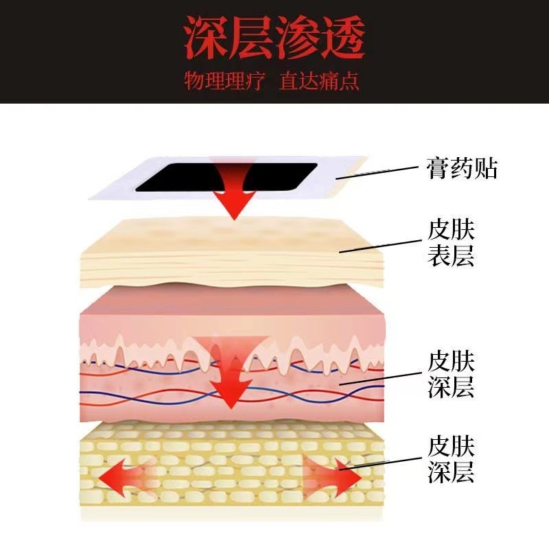 サソリ毒風追い膏、腰痛、首、肩、腰椎関節痛、発熱鎮痛パッチ、露店商品|undefined