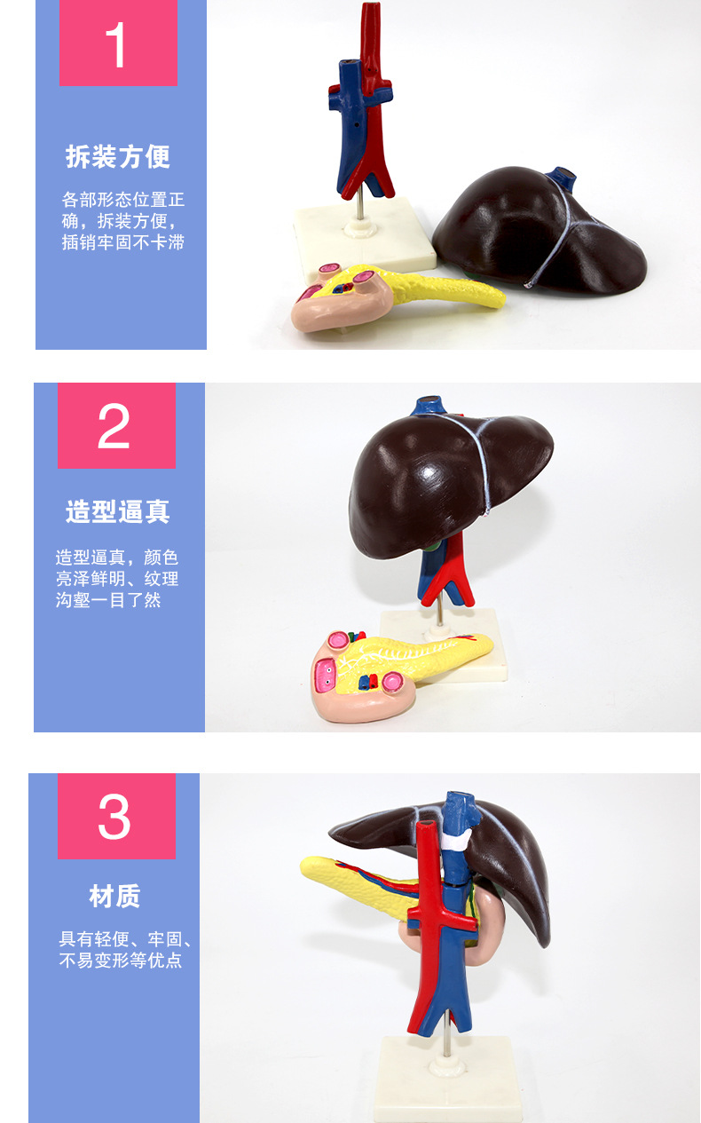 33216肝、十二指肠、胰脏生物模型_08.jpg