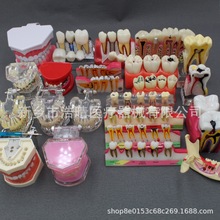 ���ƽ̌Wģ���t����ͨģ�;C�ϲ���ģ�Ϳɲ�ж��ģ�Nֲ�w�ޏ�ģ��