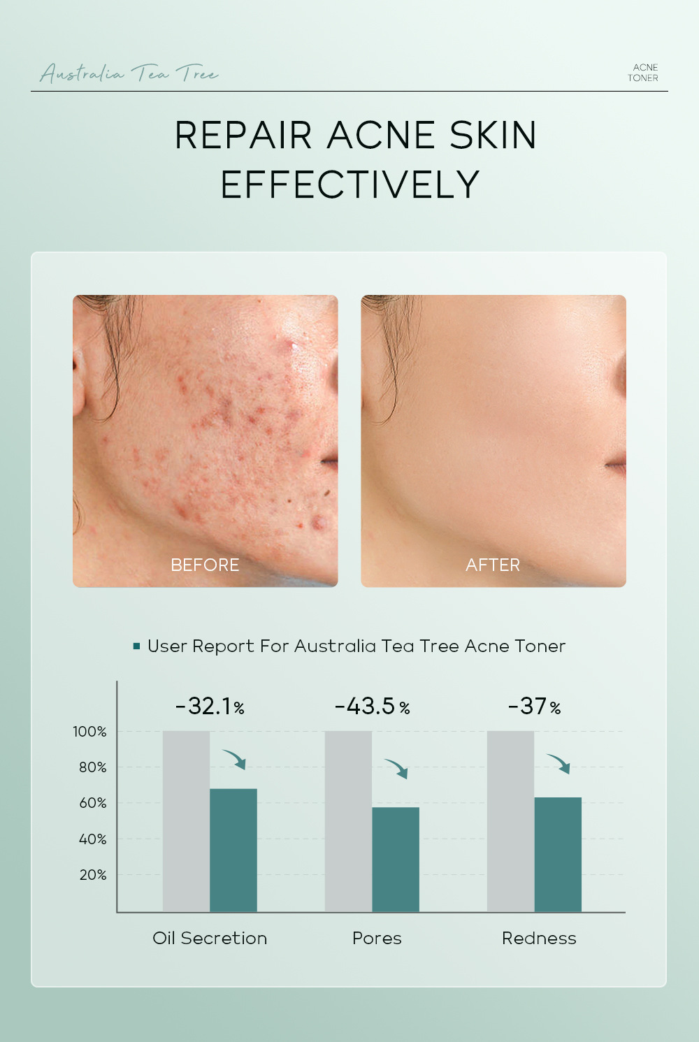 Manufacturer's in-stock cross-border LAIKOU Australian Tea Tree anti-acne Toner 100ml for hydrating and moisturizing undefined