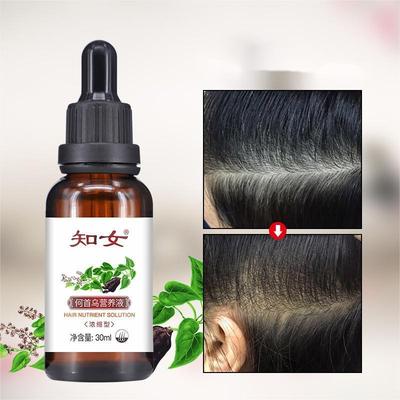Polygonum Nutrient solution UFA Black Hair care scalp Essence liquid Hair Black Hair care essential oil machining OEM