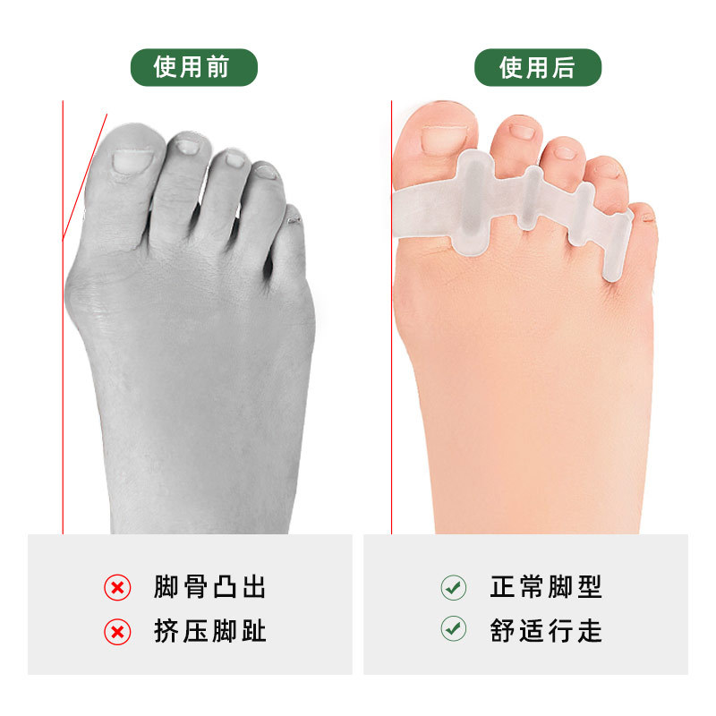 Ajustador valgus sebs separador de dedos de cuatro agujeros separador de dedos para hombres y mujeres abrazadera de pies amortiguador de compresión