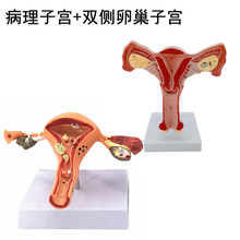 女性生殖模器模型女性生殖模器模型私密子宫模型教具卵巢解剖