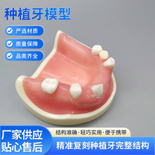 �������M�Nֲ����ģ�� PH2054��ǻ���ܷNֲ��׸C���A��Ӗ��ģ��