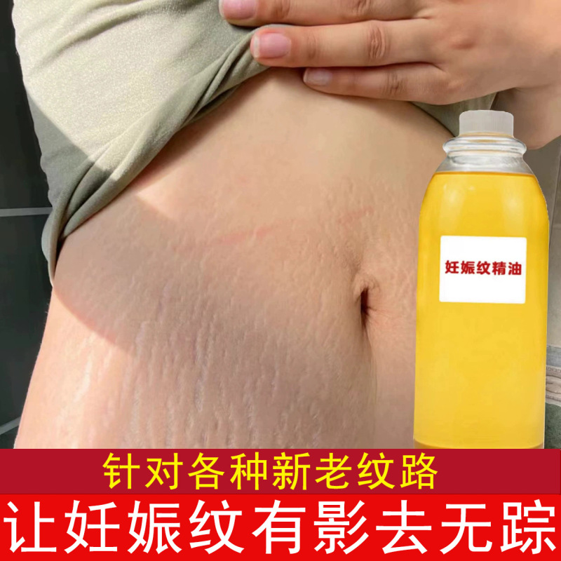 妊娠の紋様を修復して精油を薄めて妊娠の紋様を予防します。|undefined