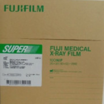 大量批发供应富士X光 绿 12x15  的医用胶片  富士X光  全国发货