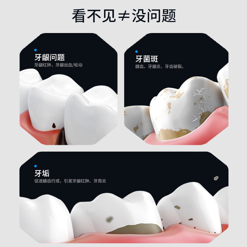 跨境超声波洁牙器洁牙机去牙结石除牙齿污垢美牙仪电动洗牙器家用|undefined