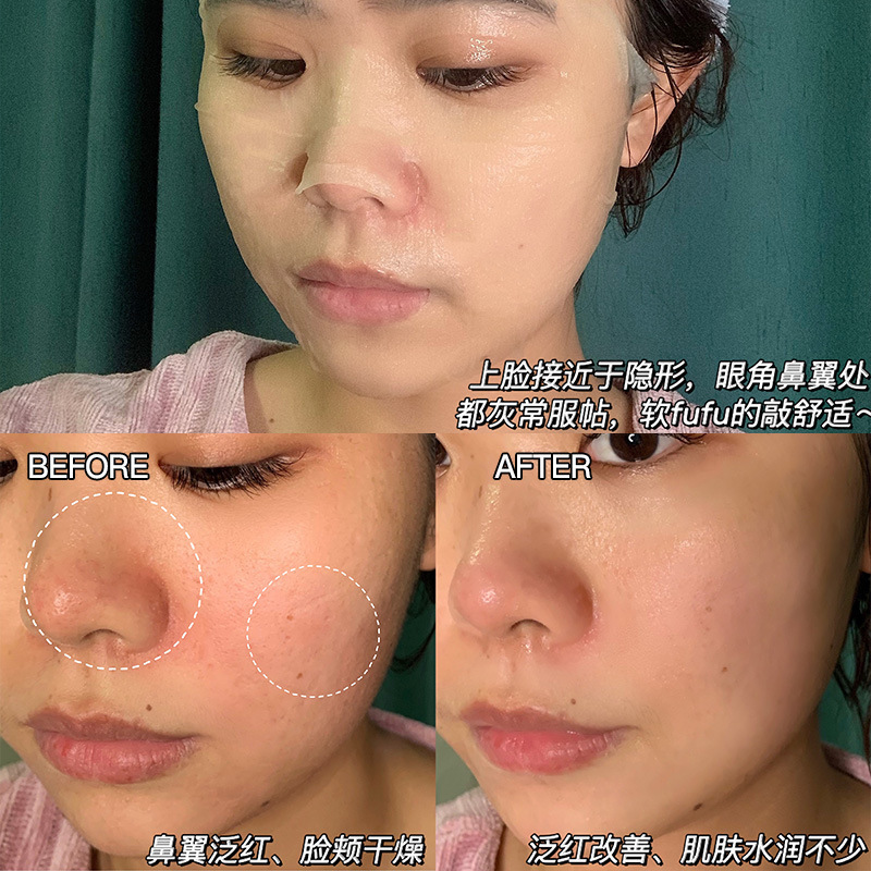 Dr.alva _ 爾博士益生菌マスク10錠ヒアルロン酸補水夜更かし修理前導精華水乳|undefined