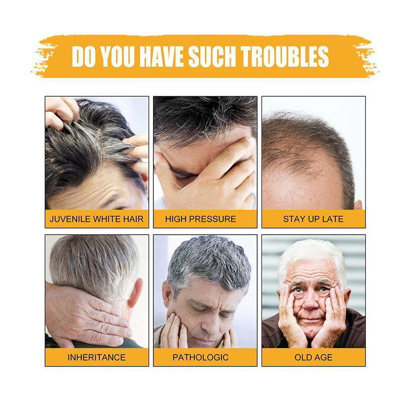 the promotional graphic for mens grey coverage bar shampoo for dark hair 50g highlights six causes of hair loss and aging including juvenile white hair high pressure stress staying up late inheritance pathologic causes and old age.