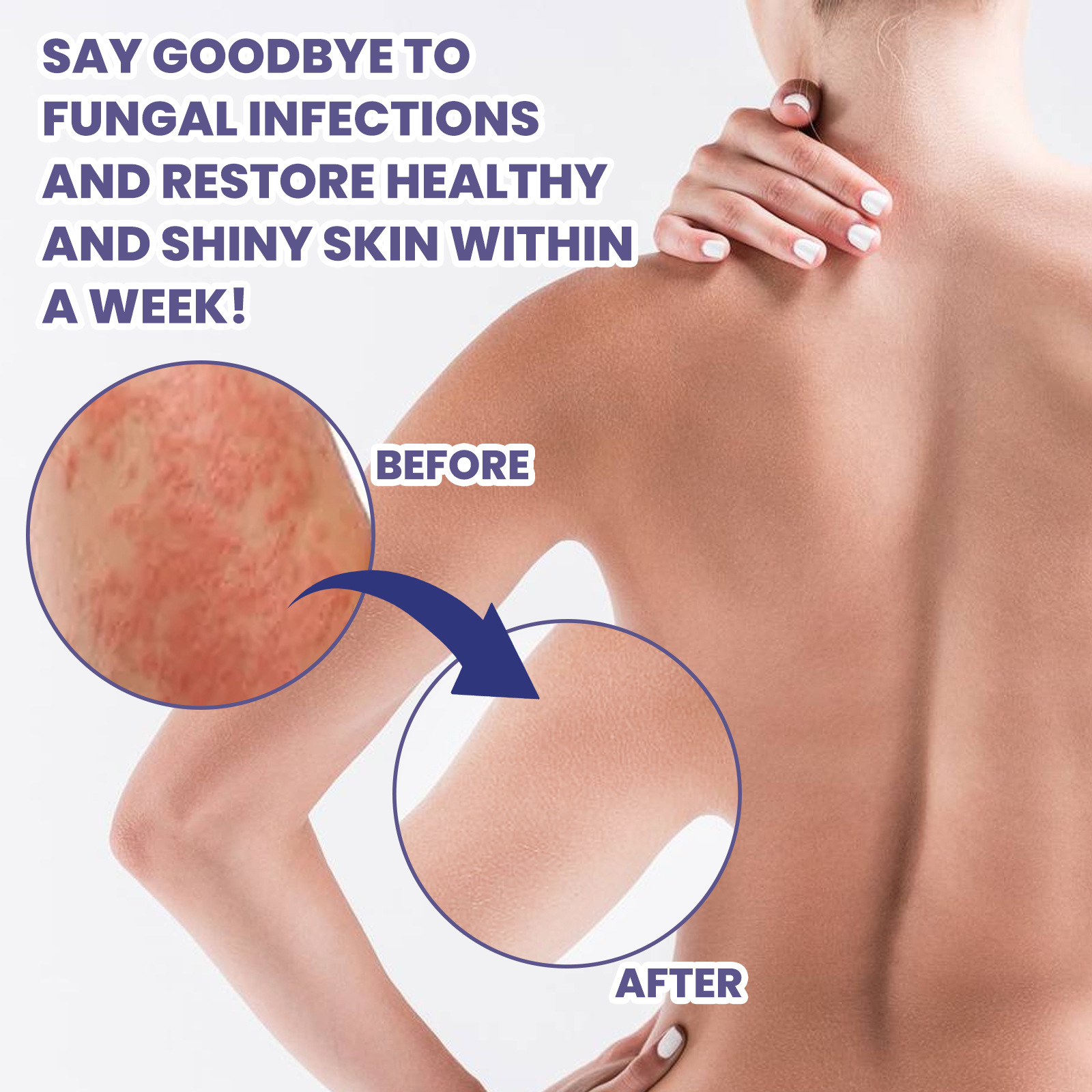 South Moon Skin Repair Cream herstelt de moshuidbarrière, verlicht roodheid en jeuk, hydraterende huidcrème_voghion.com