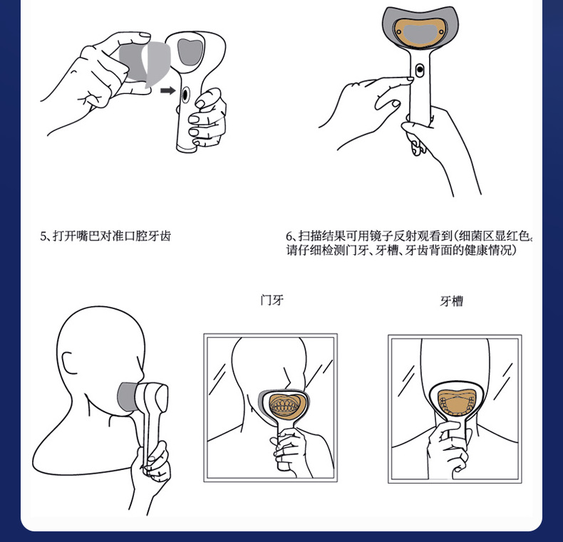 牙菌斑_10.png