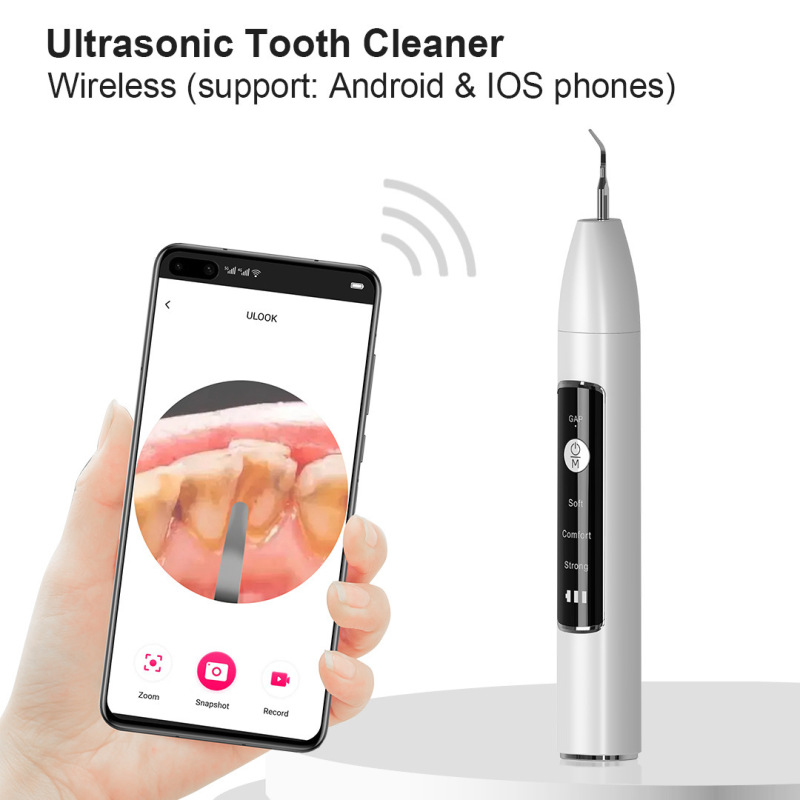 家庭用電動超音波スケーリング器携帯型歯石歯磨き器歯汚れ除去美歯器|undefined