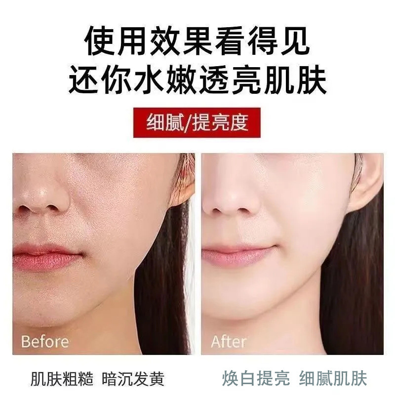 水杨酸洗面奶氨基酸温和清洁控油除螨美祛痘白收缩毛孔洁面乳正品|undefined