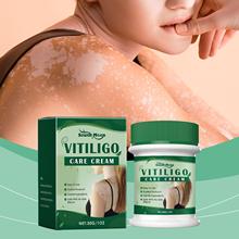 羳o˪Ƥwװ߃ܛƤwoVitiligo Cream