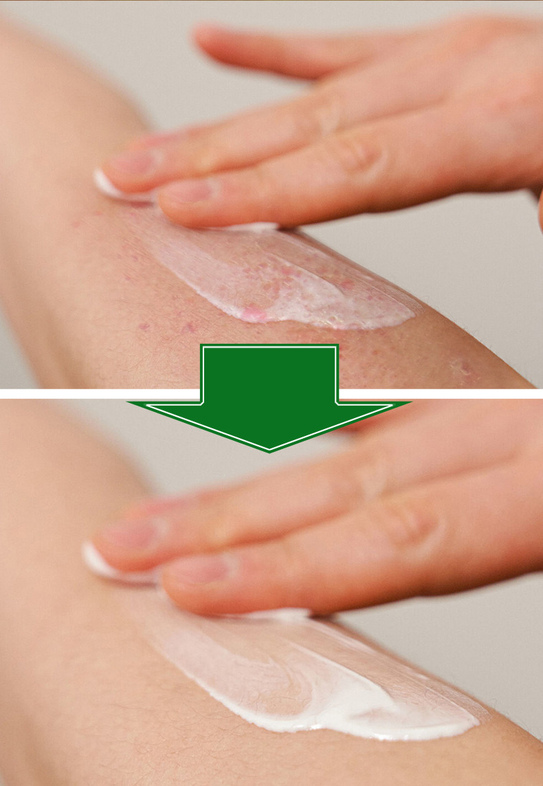 Shennong Baicao Skin Cream Herbal Ointment 20g External Use for Hand Care specifications