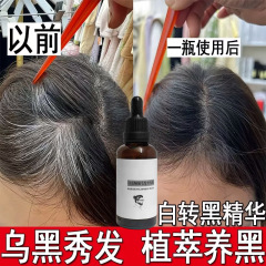 黑发原液养发液草本首乌白发转黑发精华中老年白头变黑防脱乌发液