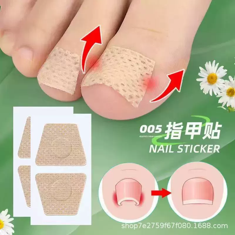 Меткируемый трансграничный ноготь на ногах, длинная плоть, прямая нашивка для ногтей Lila, корректор вросшего ногтя, нашивка для ногтей на ногах