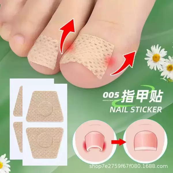Labelable Cross-Border Toenail Long Flesh Lila Straight Nail Patch Nail Groove Ingrown Nail Corrector Toenail Nail Patch
