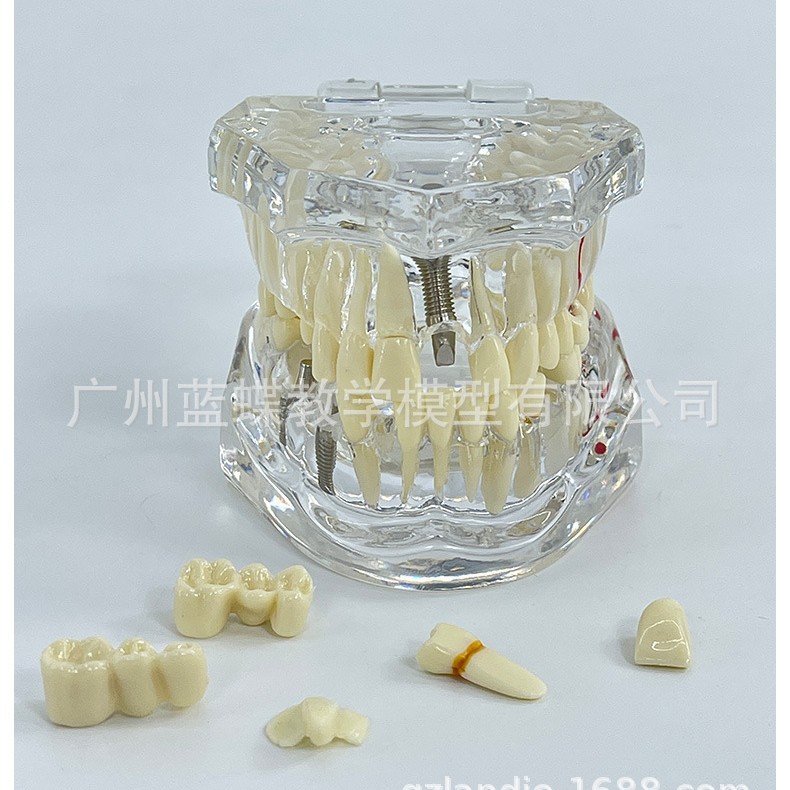 ͸��ȫ�ڲ�����ģ��ҽѧ��ѧ�ۺϲ�������������ǻ��ҽ����ͨģ��