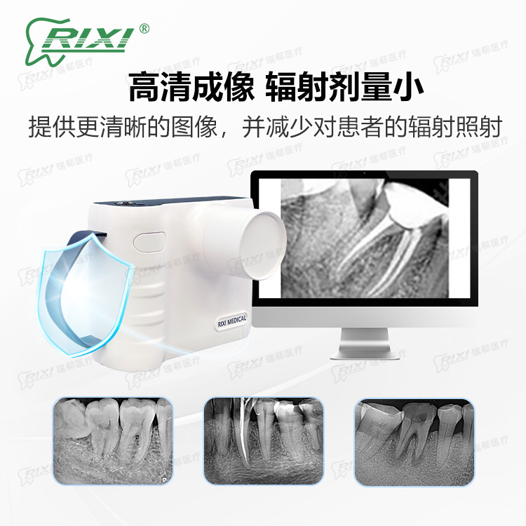 Máquina de rayos X dentales máquina de rayos X portátil de cavidad oral fotocamera de mano sensor digital de alta definición