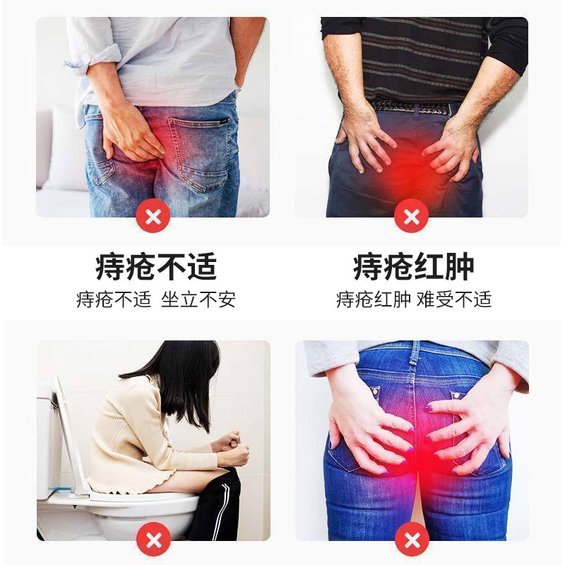 痔軟膏、痔軟膏、痔軟膏、痔軟膏、ハーブ痔軟膏、肛門外痔軟膏、卸売|undefined