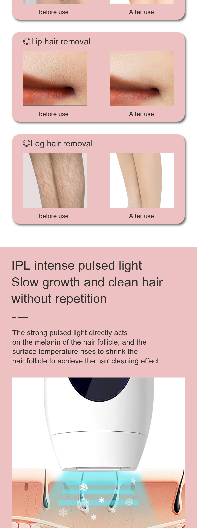 Permanent Hair Removal Device For Home Use With Flashes System_voghion.com