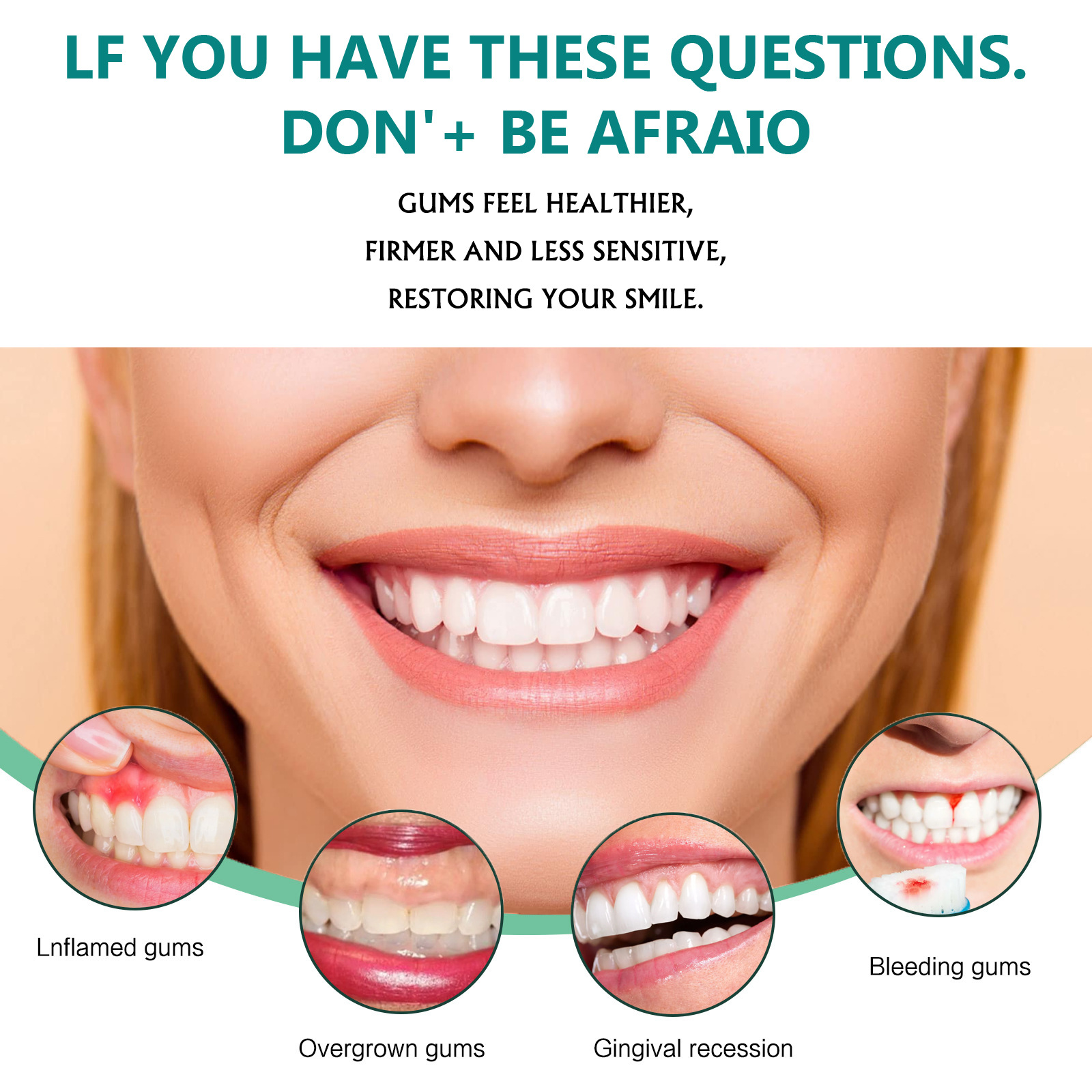 EELHOE 牙齦滴劑 修護牙齦腫痛清潔牙漬護齦煥白牙齒口腔護理精華