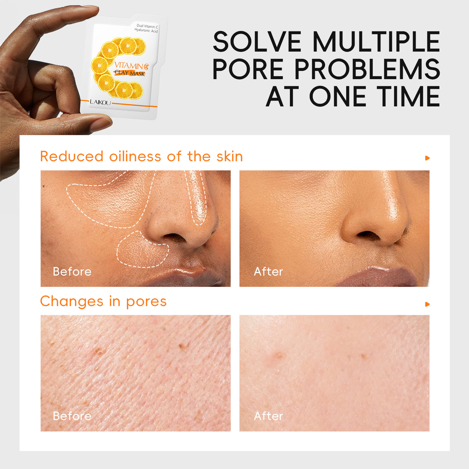 Cross-border in-stock new LAIKOU Vitamin c Mud Mask 5g*12 for pore cleansing, hydration and moisturizing, one-stop delivery undefined