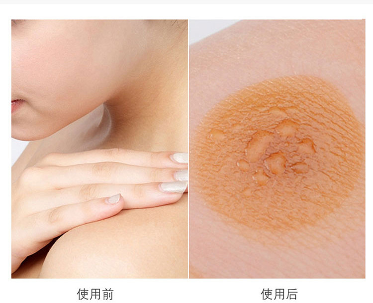 Moxibustion Tube Hanging Moxa Burner with Heat Shield and Straps for Home Body Use quality and texture