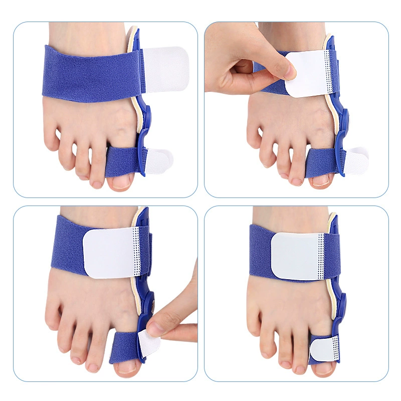 The thumb florer furry device with large foot bone heavy toe divide the toe can adjust the magic stick toe appliance