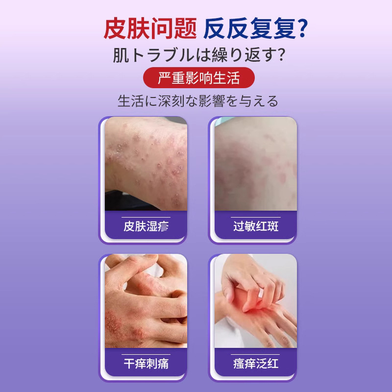 岩井弘皮膚湿かゆみ皮膚炎かゆみ止め太ももの根内肛門私処陰嚢湿かゆみ工場直営|undefined