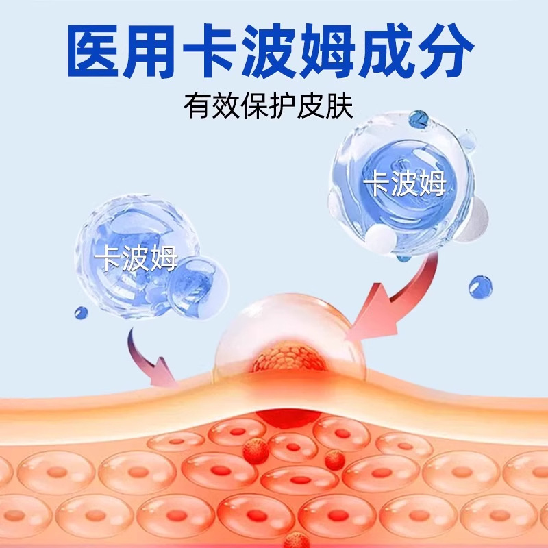 Yifangshuo 医療用湿式修復ドレッシングメーカーは、湿疹の外用修復に使用できる製品を迅速に発送するように直接指示しています。|undefined