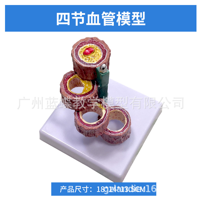 ���������״��������Ѫ�ܶ���ģ��Ӳ��ģ����������ģ��Ѫ˨ģ��