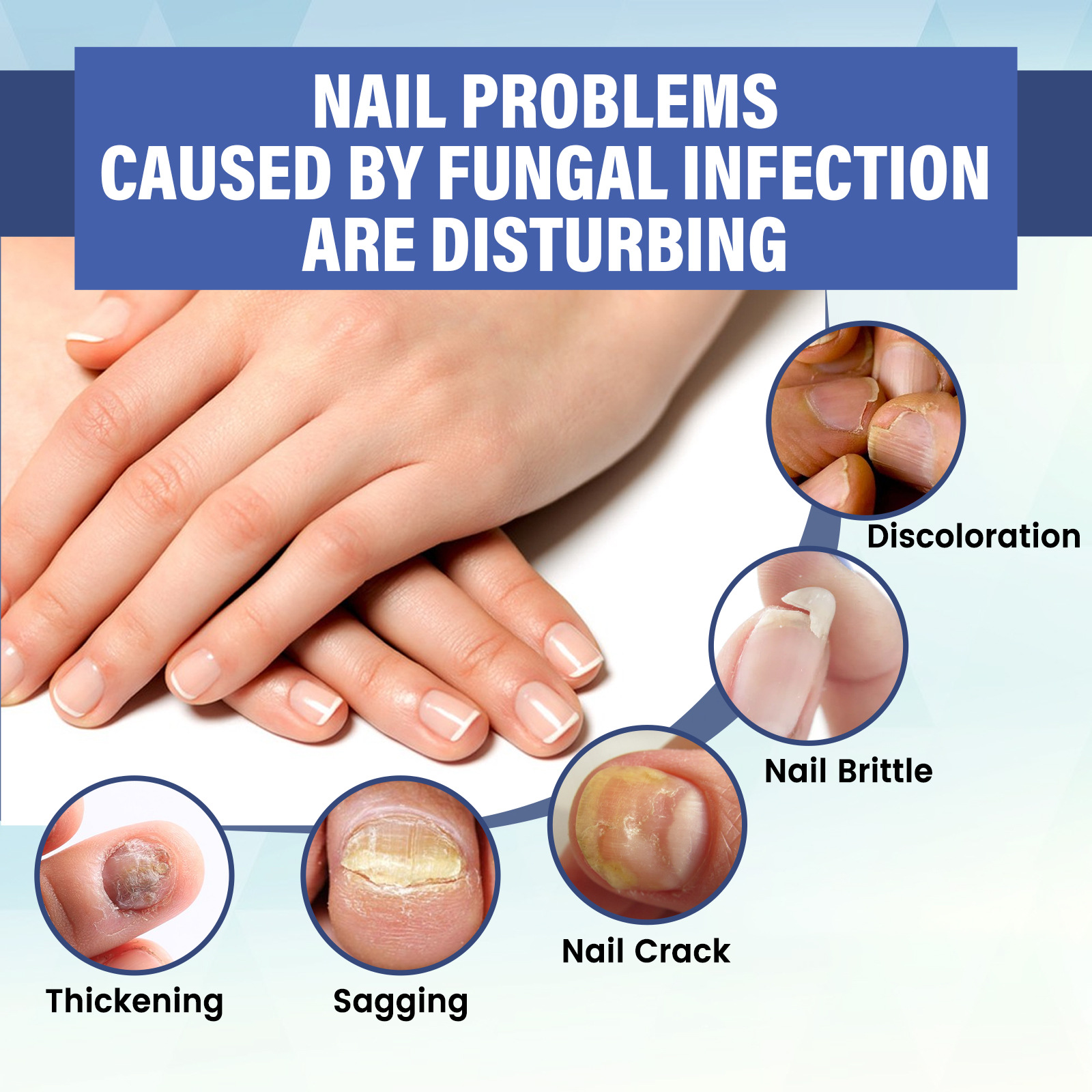 Nail Repair LED Phototherapy Instrument - Perfect for Home Use