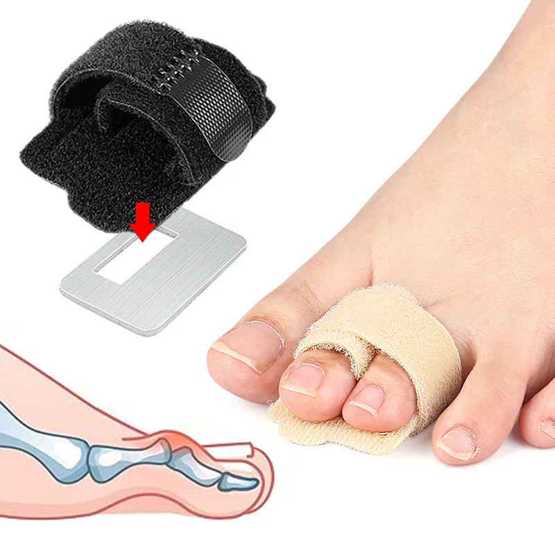 Toe Stabilizing Strap Adjustable with Aluminum Plate, Protective Toe-Fixing Belt, One Size
