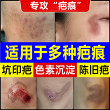 ̺۸ȥf̂gϰ̰͹oʸaԺ̺۸