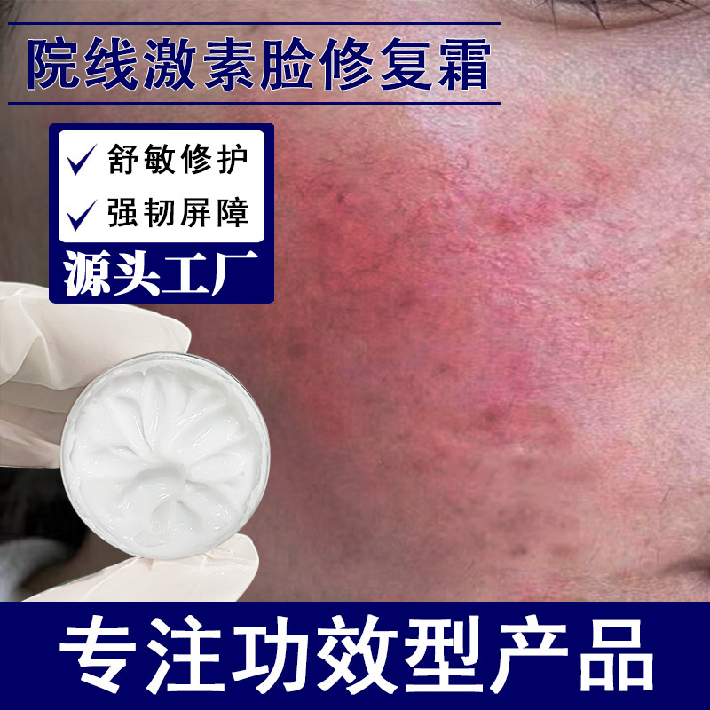 激素脸修复霜退红退敏去红血丝修护角质舒缓肌肤屏障止痒退红面霜