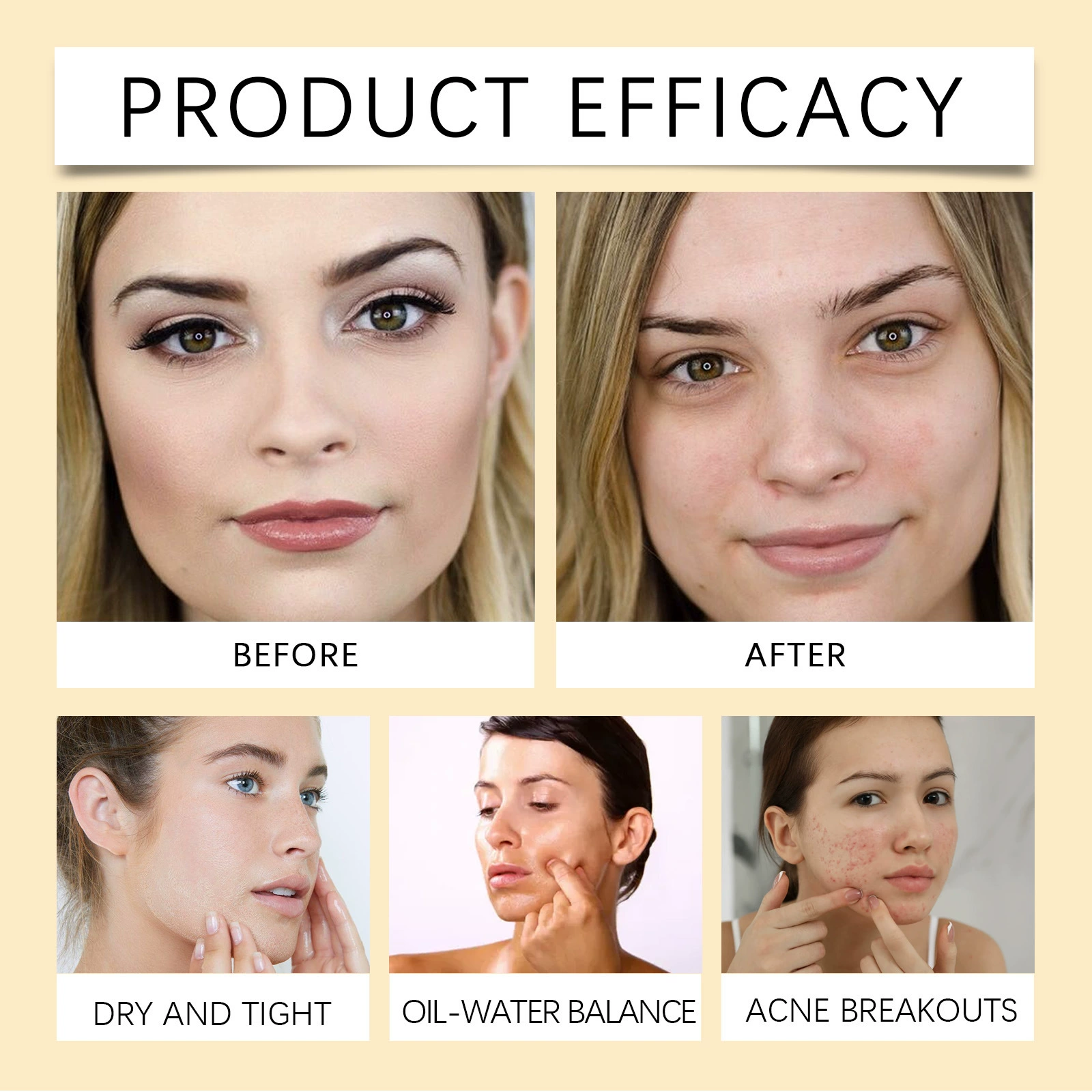 Refreshing Cleansing Oil (EELHOE) Centella Makeup Remover, Gentle Soft Cleansing, 100 ml